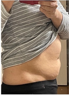 女性ヒーリングコーチのダイエット効果ビフォア